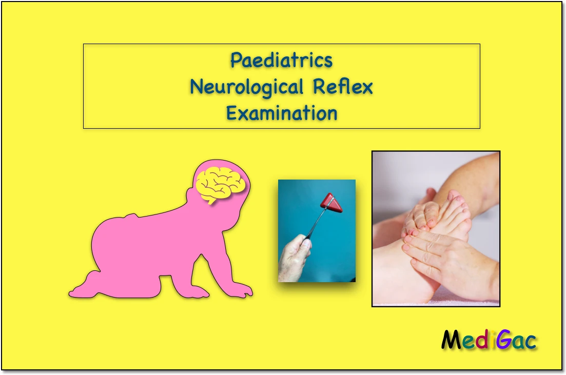 Paediatrics Neurological examinations